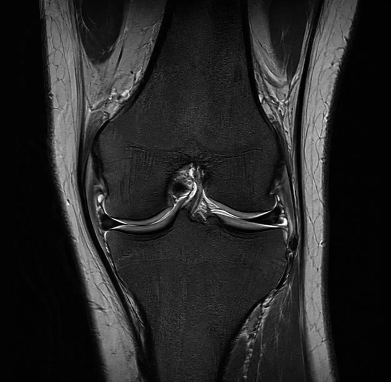 Knee MRI uploaded with patient referral